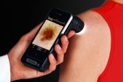 El centro de salud de Estella participa en un proyecto piloto de ‘teledermatología’